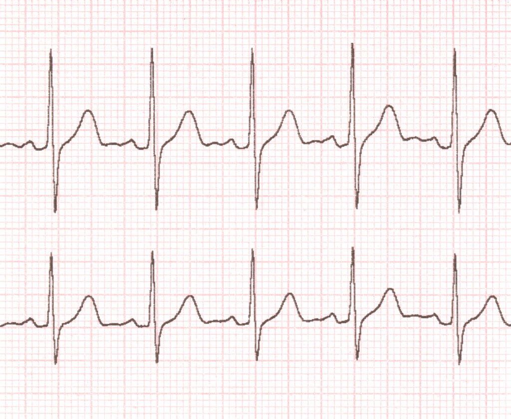 Cardiogramm