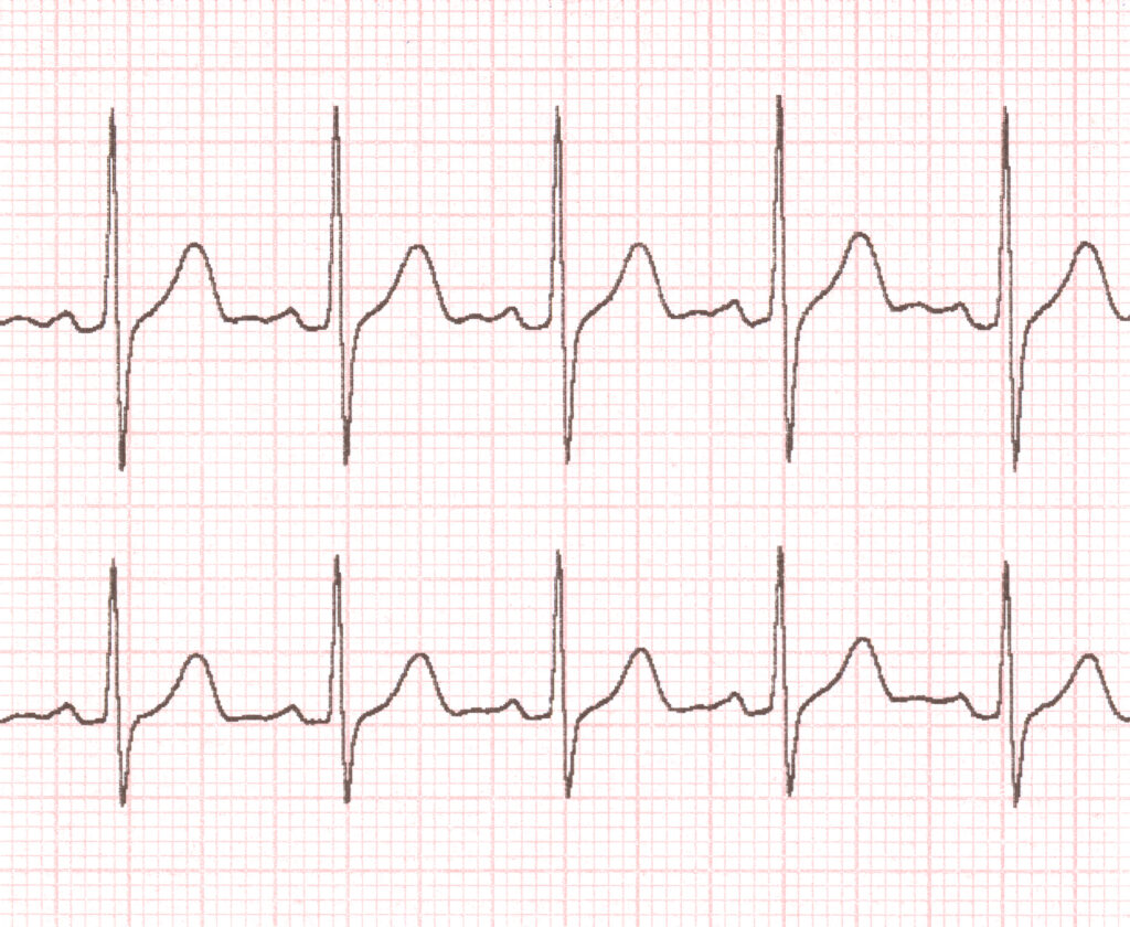 Cardiogramm