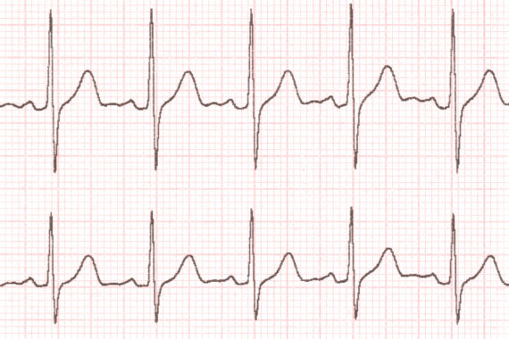 Cardiogramm